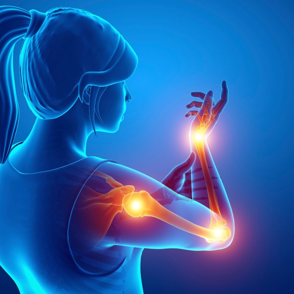 Studies show red light therapy helps pain and inflammation. Avanti Body 3d body render showing inflammation and pain in the shoulder, elbow and hand